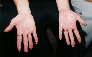Two open palms with small reflective specks